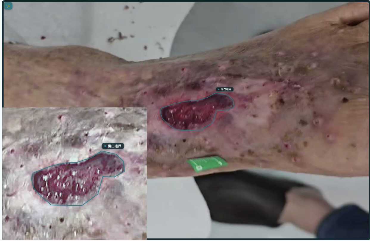 wound closeup