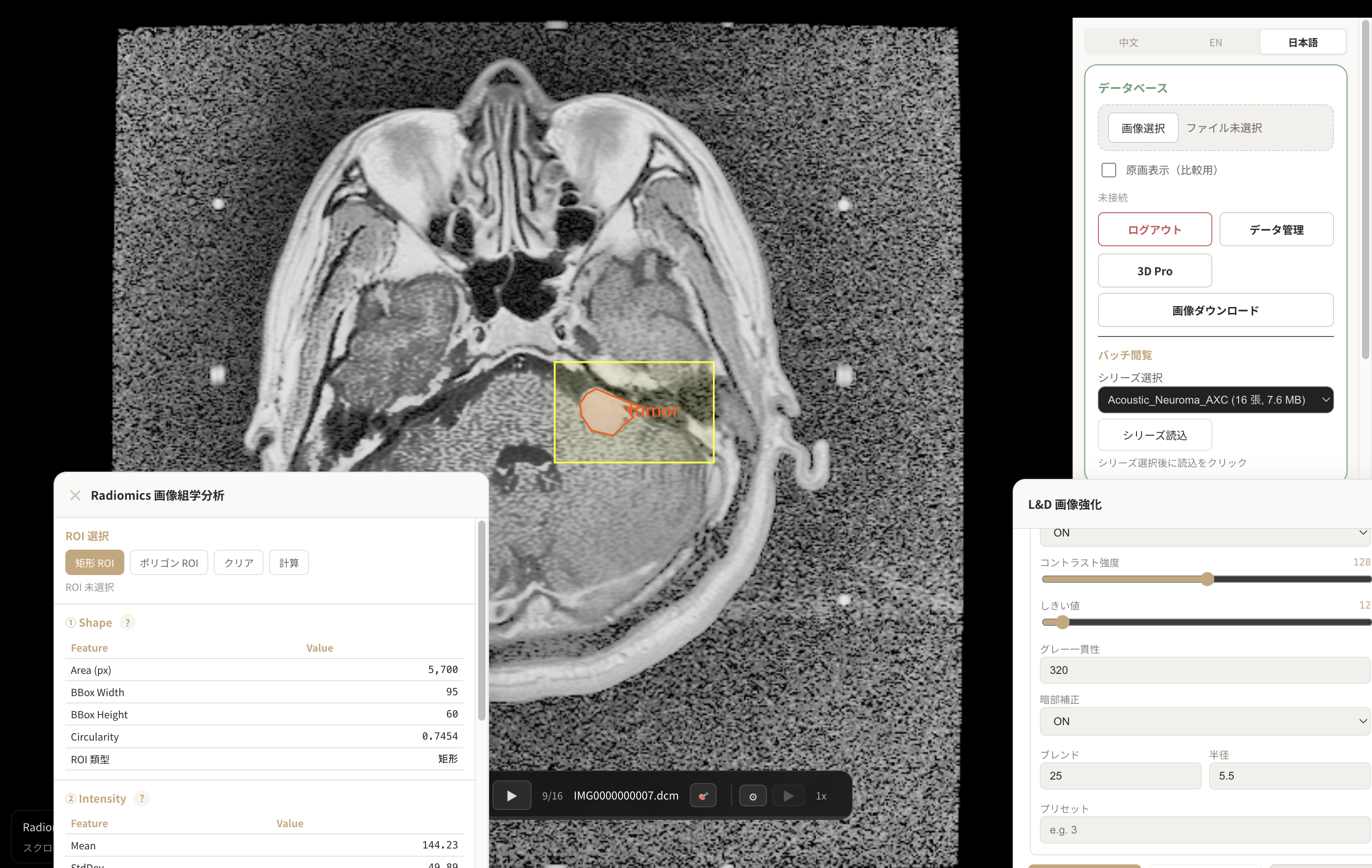radiomics marking